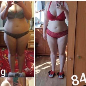 metamorfozy przed i po aplikacja miazga 00295