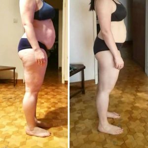 metamorfozy przed i po aplikacja miazga 00297