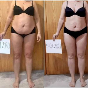 metamorfozy przed i po aplikacja miazga 00298