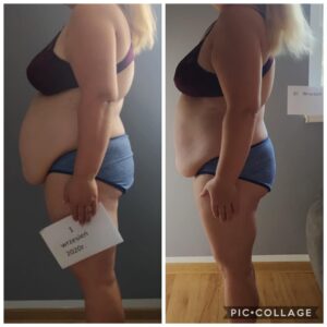 metamorfozy przed i po aplikacja miazga 00299