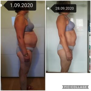 metamorfozy przed i po aplikacja miazga 00300