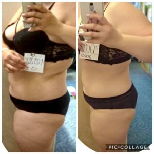 metamorfozy przed i po aplikacja miazga 00301