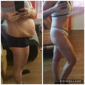 metamorfozy przed i po aplikacja miazga 00302