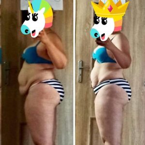 metamorfozy przed i po aplikacja miazga 00303