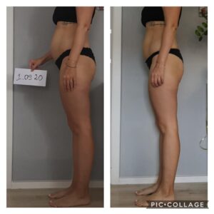 metamorfozy przed i po aplikacja miazga 00304