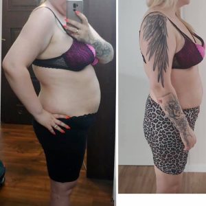 metamorfozy przed i po aplikacja miazga 00305