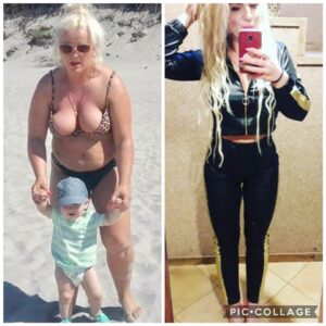 metamorfozy przed i po aplikacja miazga 00308