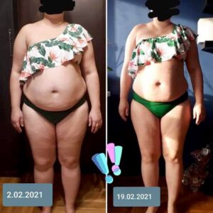 metamorfozy przed i po aplikacja miazga 00309