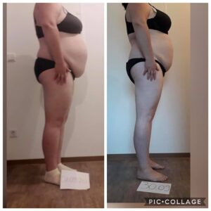 metamorfozy przed i po aplikacja miazga 00310