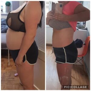 metamorfozy przed i po aplikacja miazga 00313