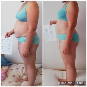 metamorfozy przed i po aplikacja miazga 00314